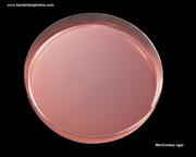 MacConkey agar agar plate